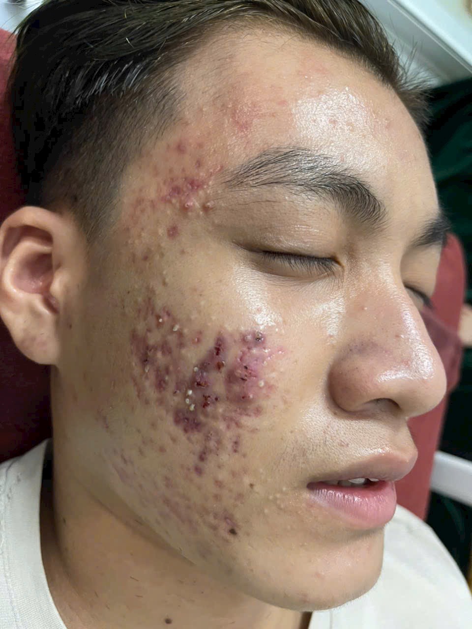 Korea Spa - Spa Chuyên điều trị mụn nám tàn nhang và tắm trắng tại Đường Phạm Thị Giây Hóc Môn