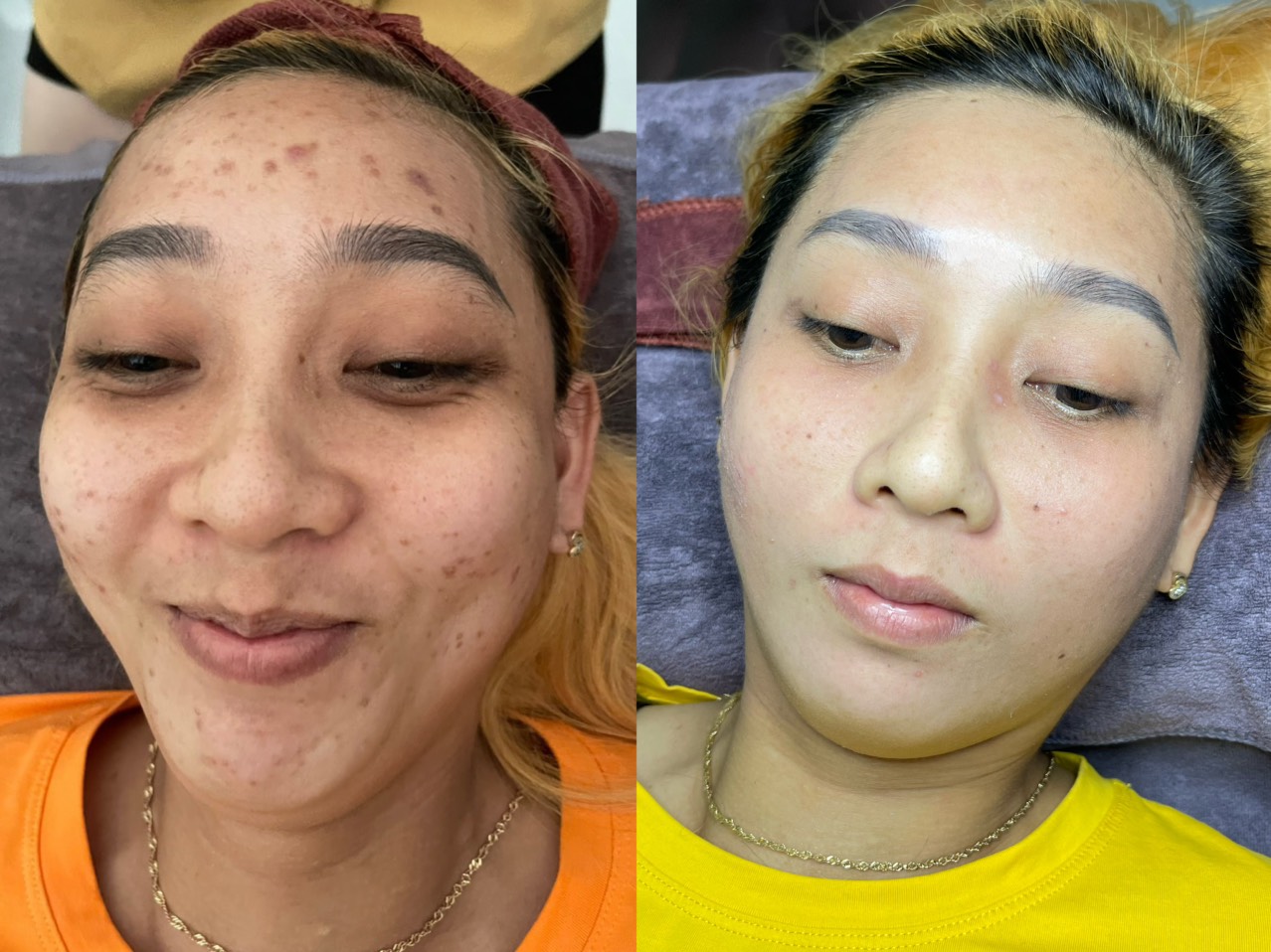 Korea Spa - Spa Chuyên điều trị mụn nám tàn nhang và tắm trắng tại Đường Phạm Thị Giây Hóc Môn