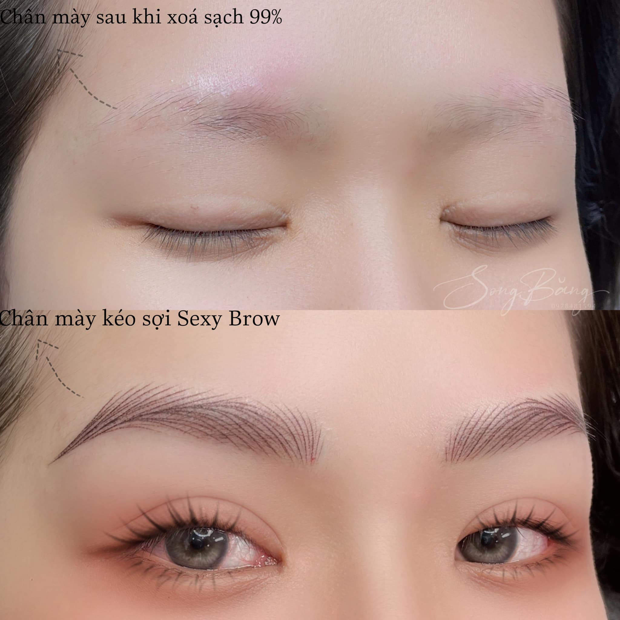 Xóa chân mày tại song băng - Địa Điểm Phun Xăm Thẩm Mỹ Đẹp, Chuyên Nghiệp và Uy Tín Nhất Hóc Môn