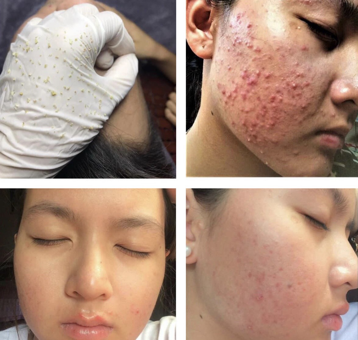 Ruby Spa - Spa Chuyên điều trị hôi nách thâm nách, làm hồng vùng kín số 1 Hóc Môn