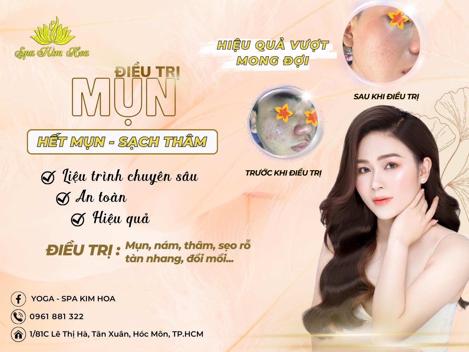 spa kim hoa viện điều trị da uy tín hóc môn